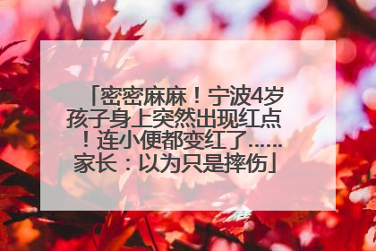 密密麻麻！宁波4岁孩子身上突然出现红点！连小便都变红了……家长：以为只是摔伤